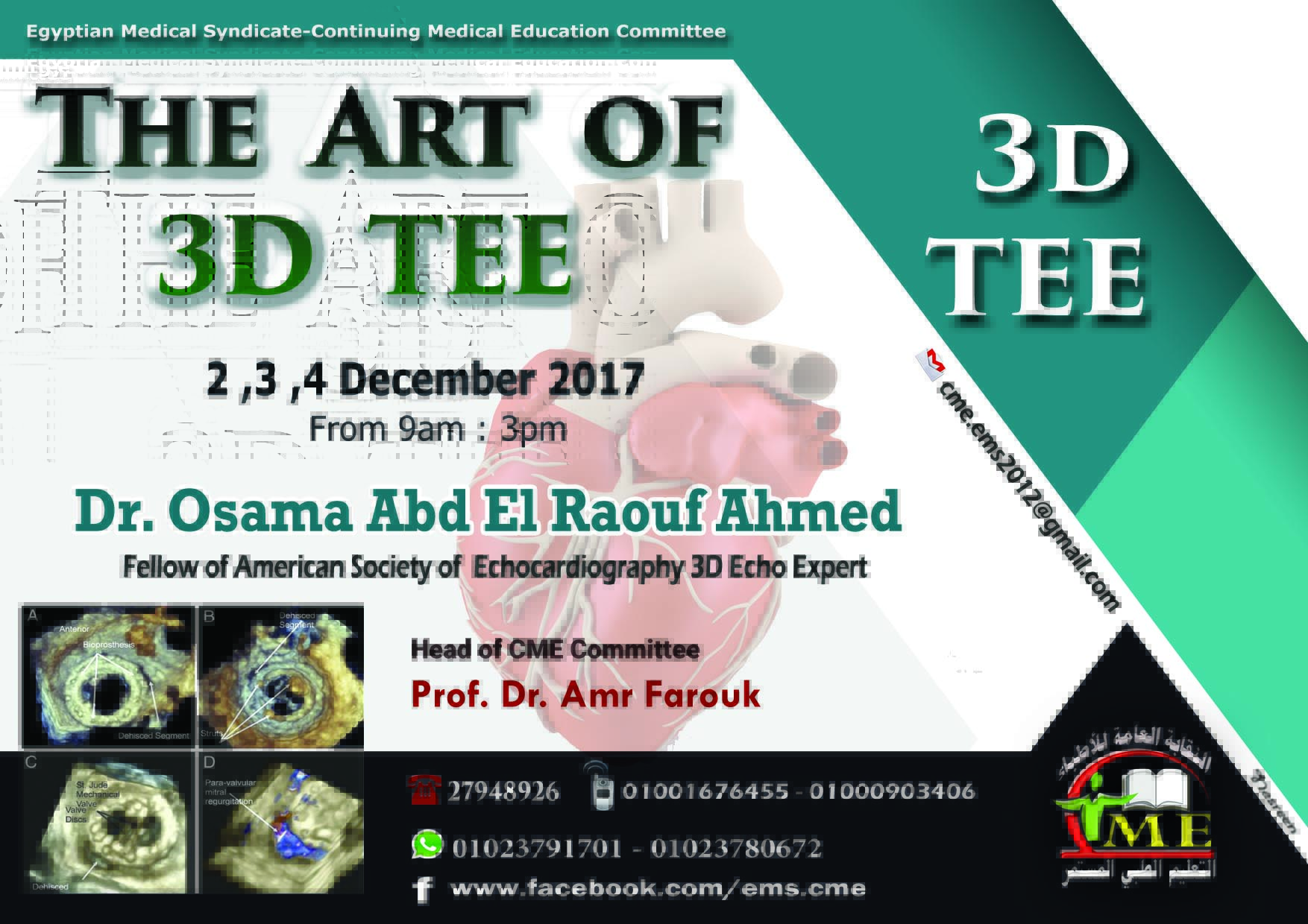 The Art of 3D TEE